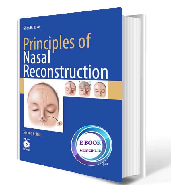 دانلود کتاب Principles of Nasal Reconstruction ( ORIGINAL PDF)  